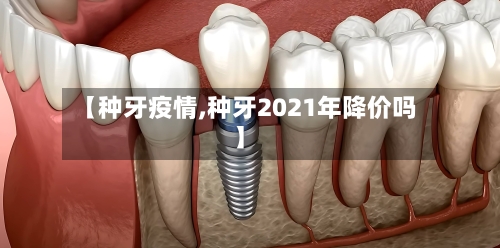 【种牙疫情,种牙2021年降价吗】