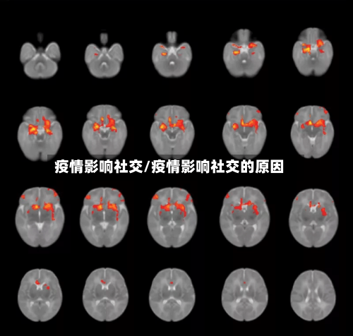 疫情影响社交/疫情影响社交的原因